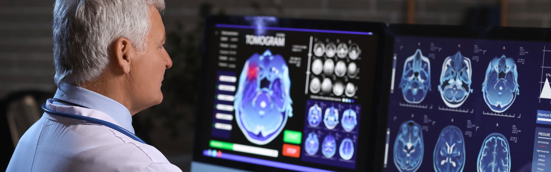 A doctor studies multiple brain scans on two large monitors, focusing on a tomogram with a red highlighted area.