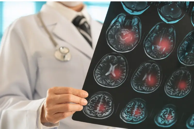 A doctor looking at brain scans