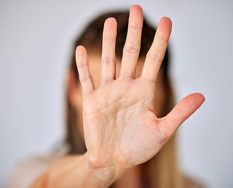 A burn injury on a hand